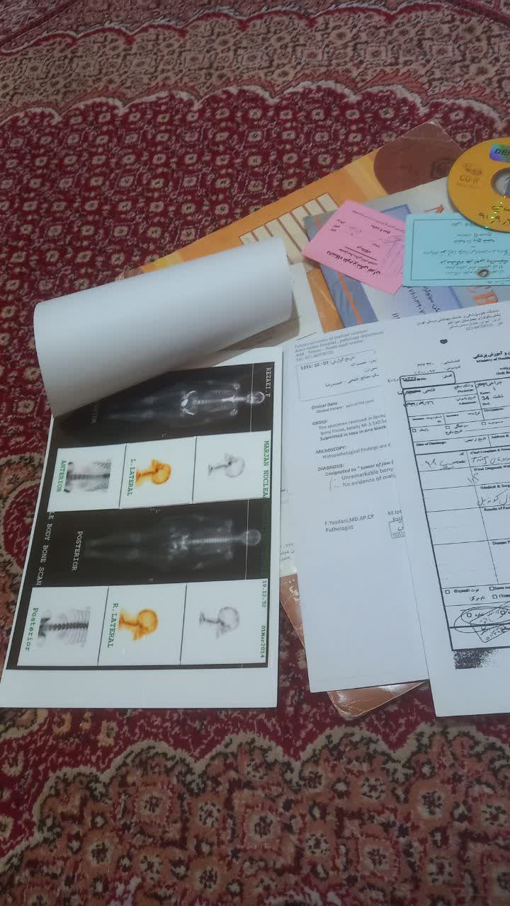 عمل جراحی فک